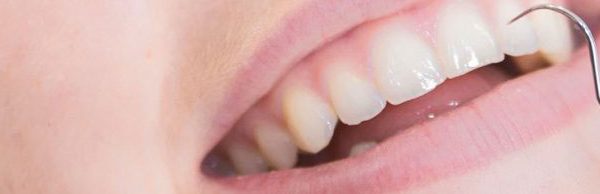 Ce este boala gingivală?